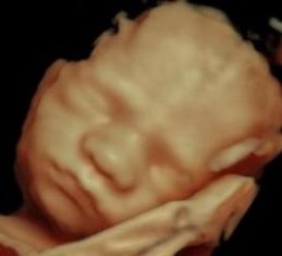 Graviditetsscanning Odense - Foster ses på skærm