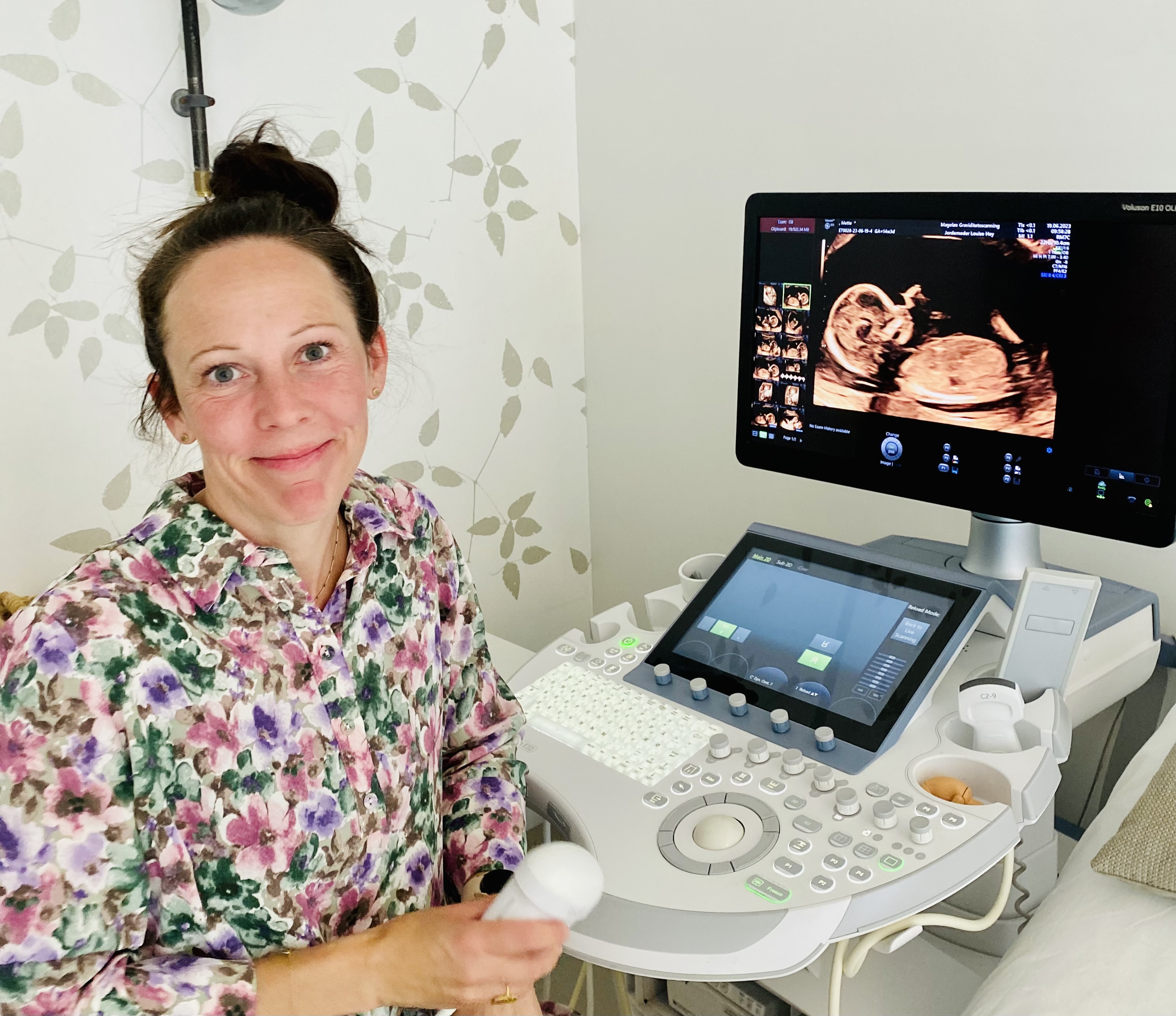 Graviditetsscanning ved Linda Andresen